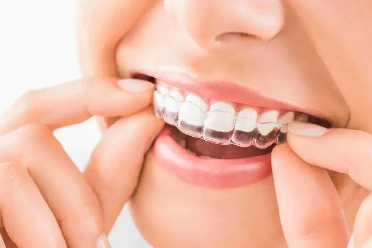 Expertos en Ortodoncia Invisible