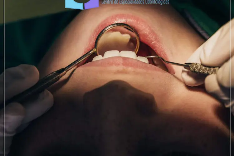 Ventajas de Invisalign First en niños