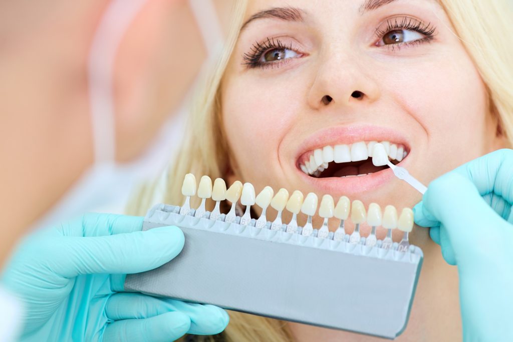 Qué son carillas dentales? precio y tratamiento -canalSALUD